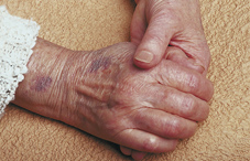 Elderly hands Elderly hands