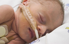 Premature baby Premature baby
