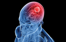 High definition brain mapping High definition brain mapping