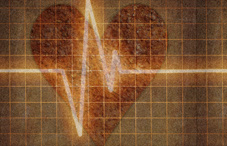 Lines of a heart monitor