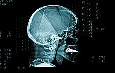 Head catscan