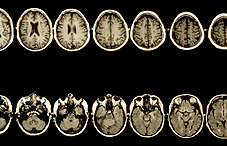 Brain scan