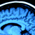 Brain MRI