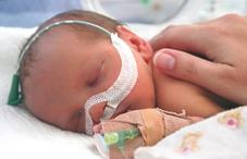 Premature baby