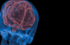 Neuropsychologists are among those identifying precursors to Alzheimer’s — work that someday might lead to treatments to slow the disease’s progression.