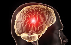 A particular protein in the hypothalamus appears to accelerate aging, a new study finds.