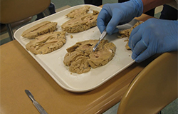 Limbic region of the brain Limbic region of the brain