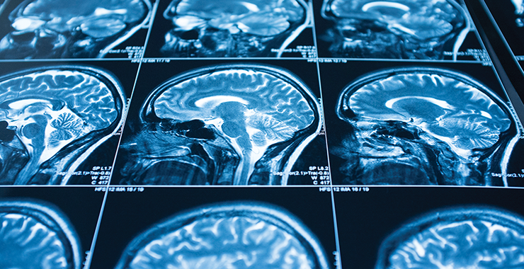 series of mri photos