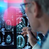 Scientist observing brain scans