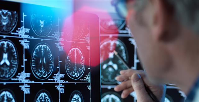 Scientist observing brain scans