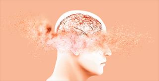 illustration of a person's brain vessels disintegrating