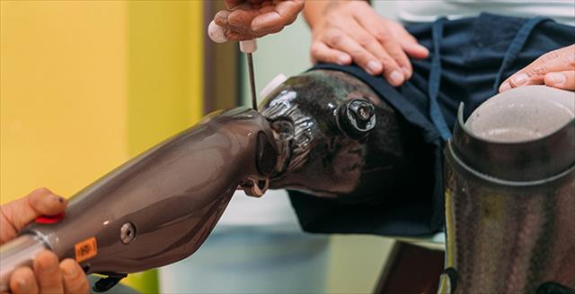 prosthetic knee being adjusted