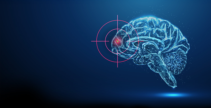 brain