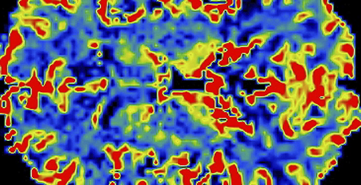 Brain Imaging Tests