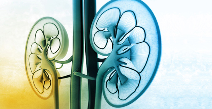 Living Well on Dialysis