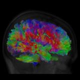 Black background with multicolored image of a brain scan