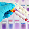 Risks and Prevention