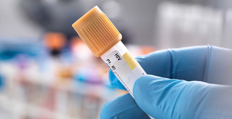 HIV testing in the 4th decade of the epidemic